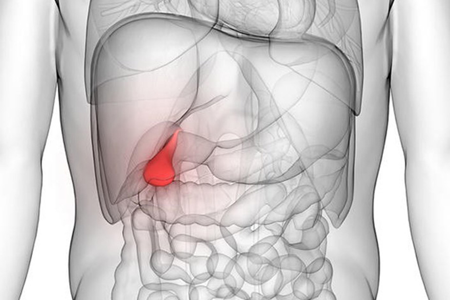 Gallbladder, Gallstones, Symptoms & Management