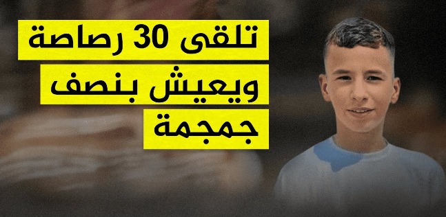 المستشفى التخصصي يعلن استعداده لعلاج أصغر أسير فلسطيني محرر 