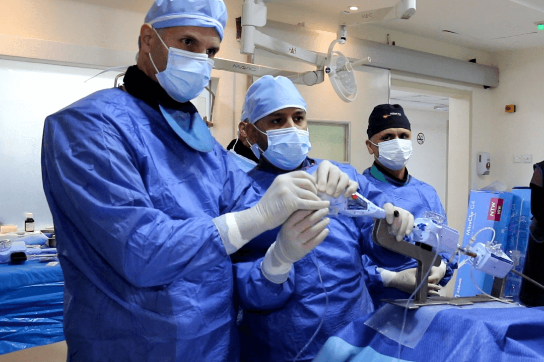 إجراء عملية اصلاح الصمام التاجي بتقنية MITRAL CLIP لأول مرة في المستشفى التخصصي