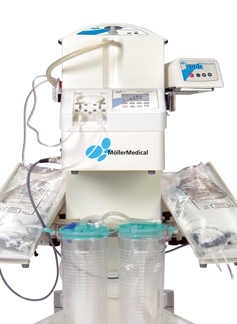 المستشفى التخصصي أول مستشفى في الأردن يدخل الجهاز الأحدث عالمياً لشفط الدهون (liposuction)