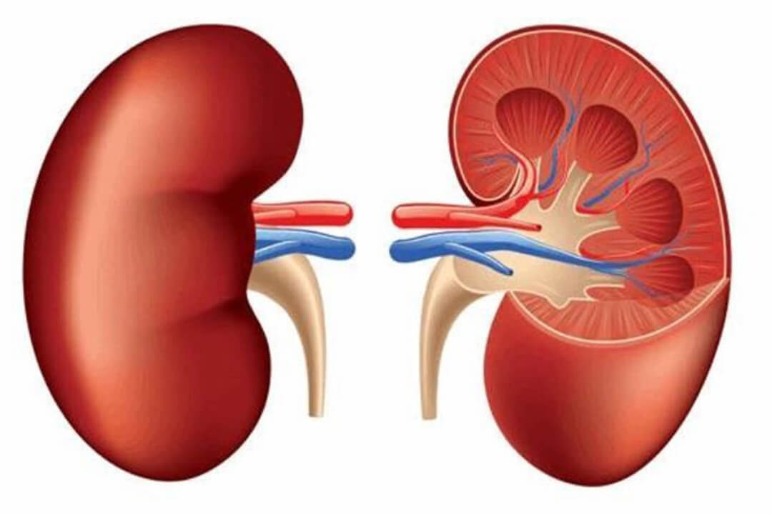 Kidney Transplant